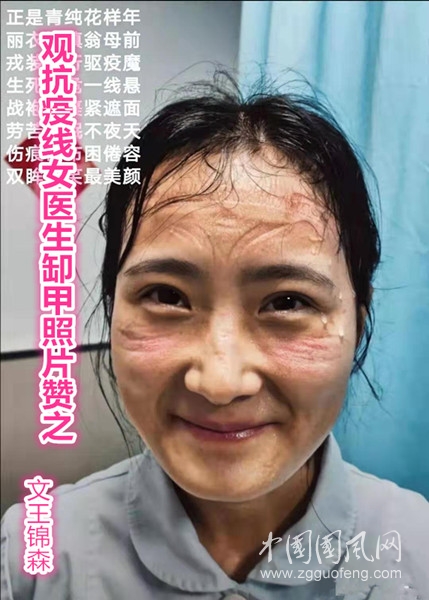  观抗疫一线女医生缷甲照片赞之