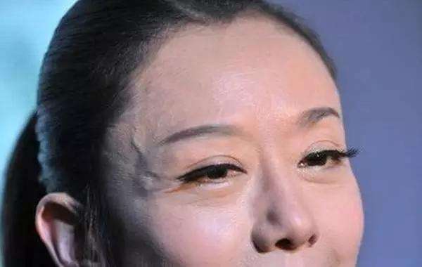 手上有青筋只是因为瘦？一起来看看吧