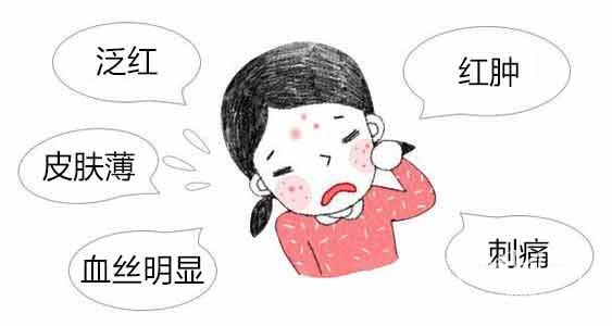 怎样消除烦人红血丝 这些方法让你轻松消除